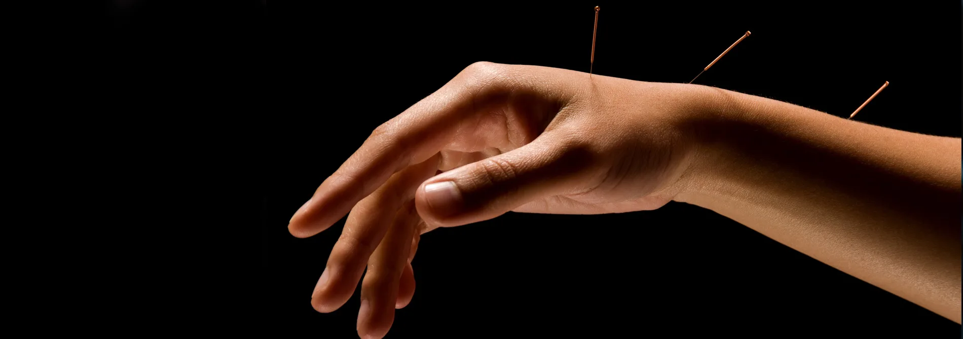 hand with Acupuncture needles